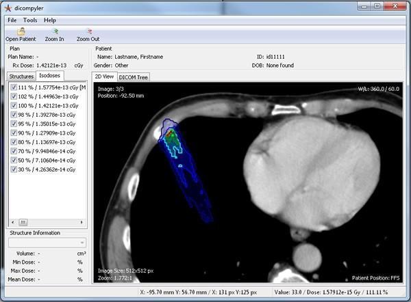 Impresión 3D en radioterapia para tratar el cáncer de piel